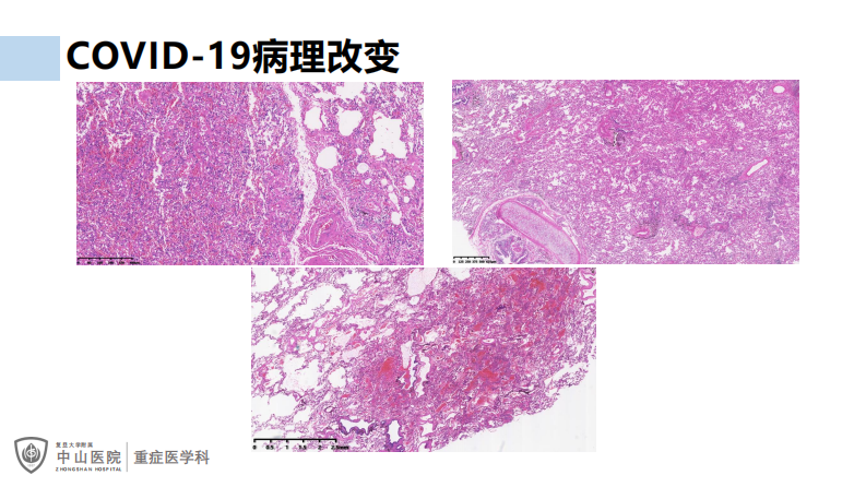 罗哲：COVID19治疗和AI-CT.pdf 第3页