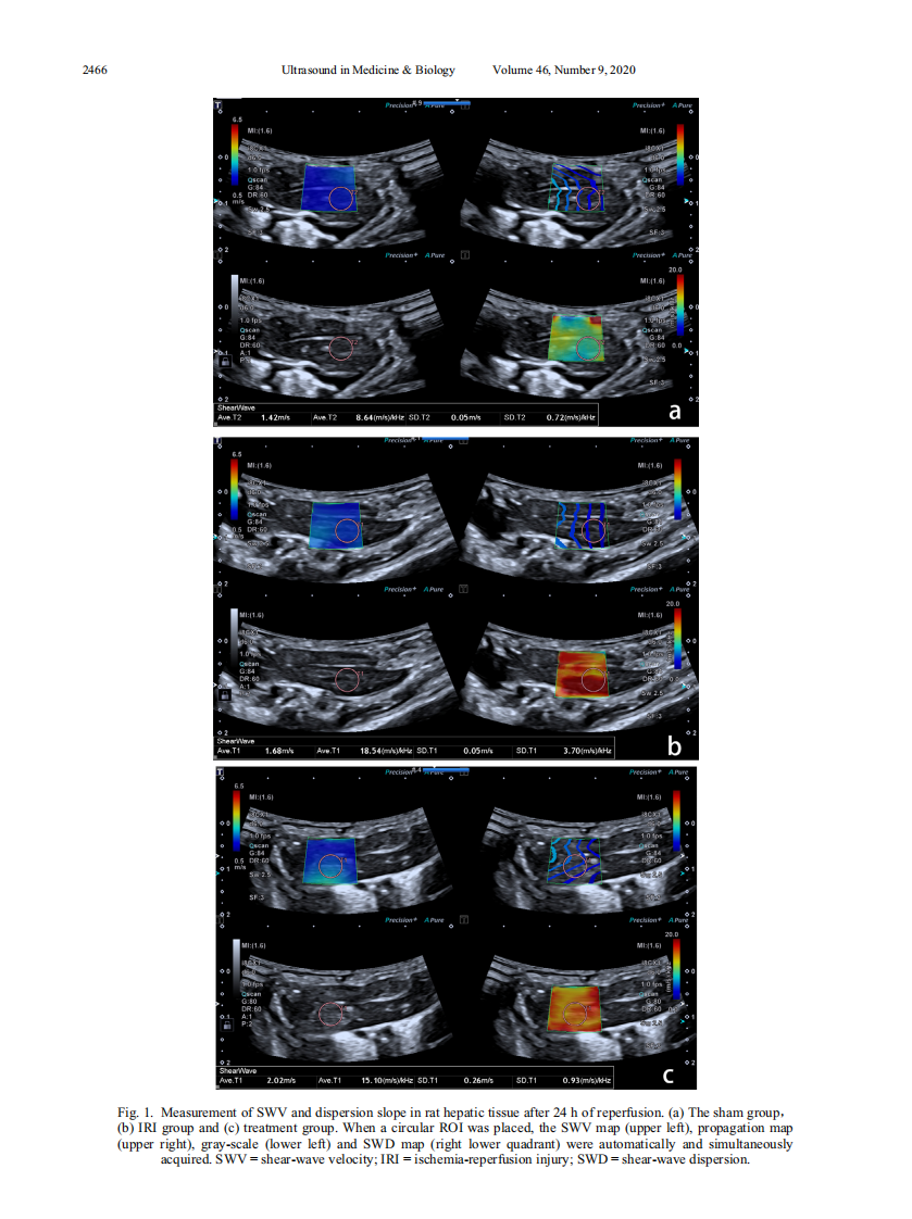 2）ULtrasound&IRI.pdf 第3页