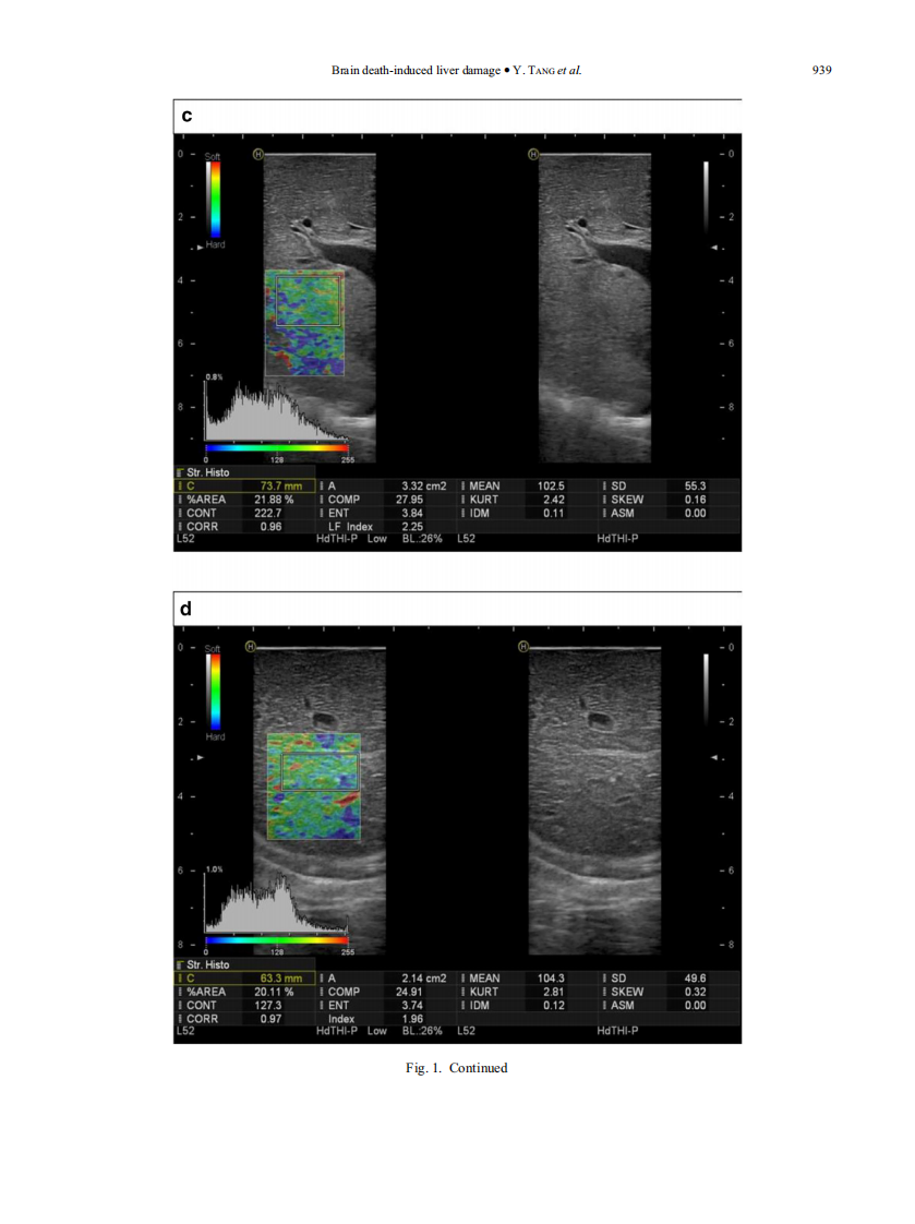 3）A comparison study of RTE and electron microscopy for assessment of liver damage.pdf 第5页