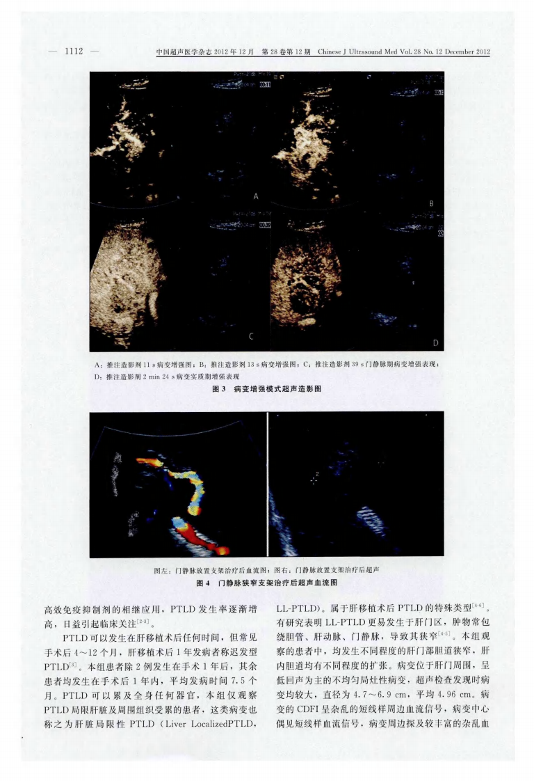 13）肝移植术后淋巴组织增生症的超声检查及超声造影分析.pdf 第3页