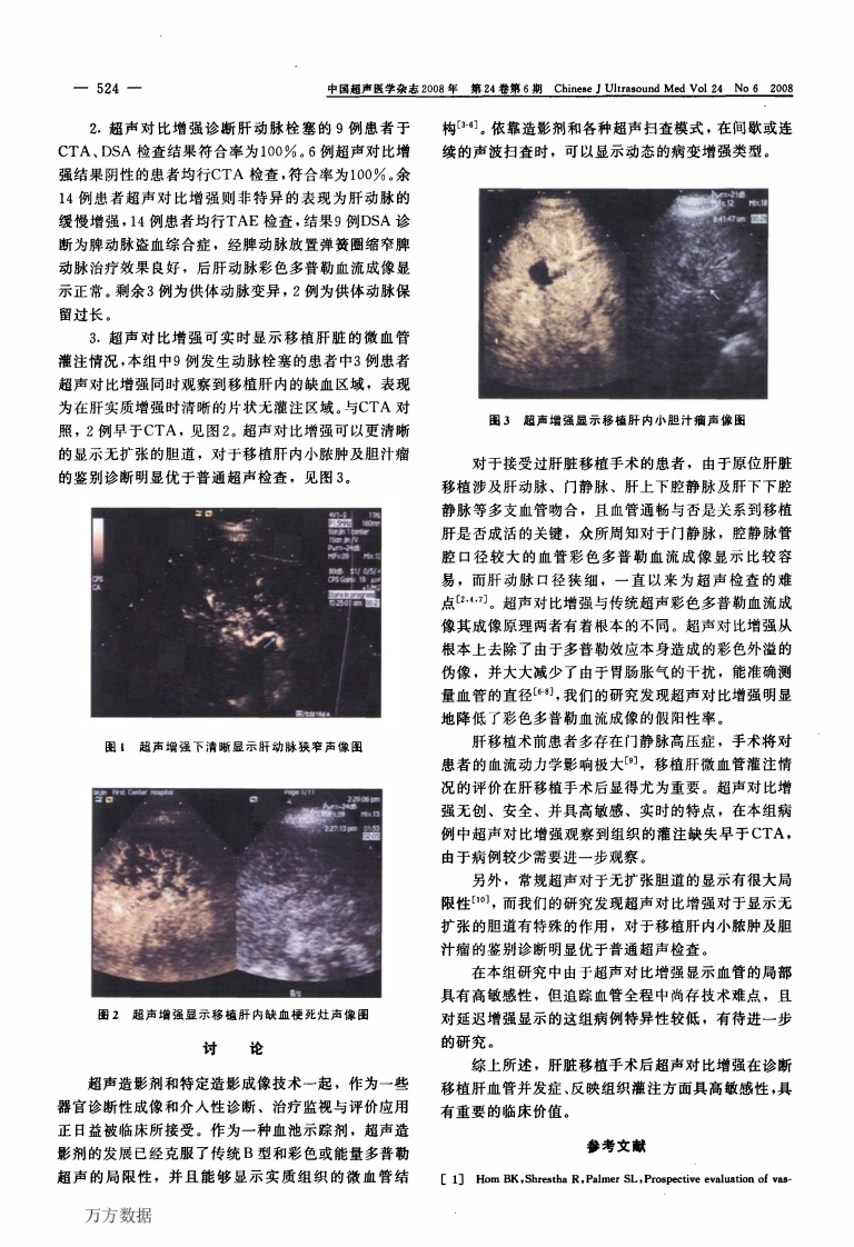 16）超声对比增强在肝移植术的应用的临床价值.pdf 第2页