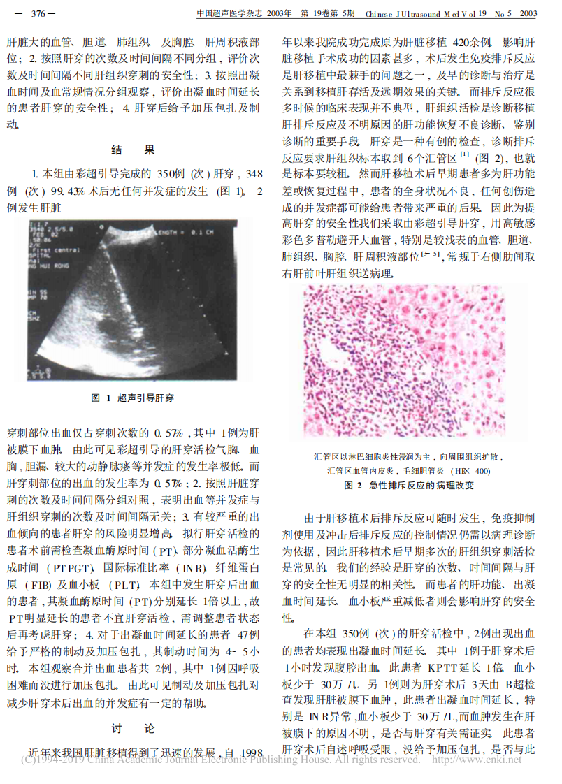 22）彩超引导肝移植患者多次反复肝组织穿刺活检安全性的评价——附350例（次）肝穿病例分析.pdf 第2页