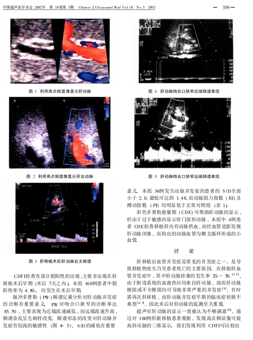 23超声对原位肝移植术后肝动脉并发症诊断新认识.pdf 第2页