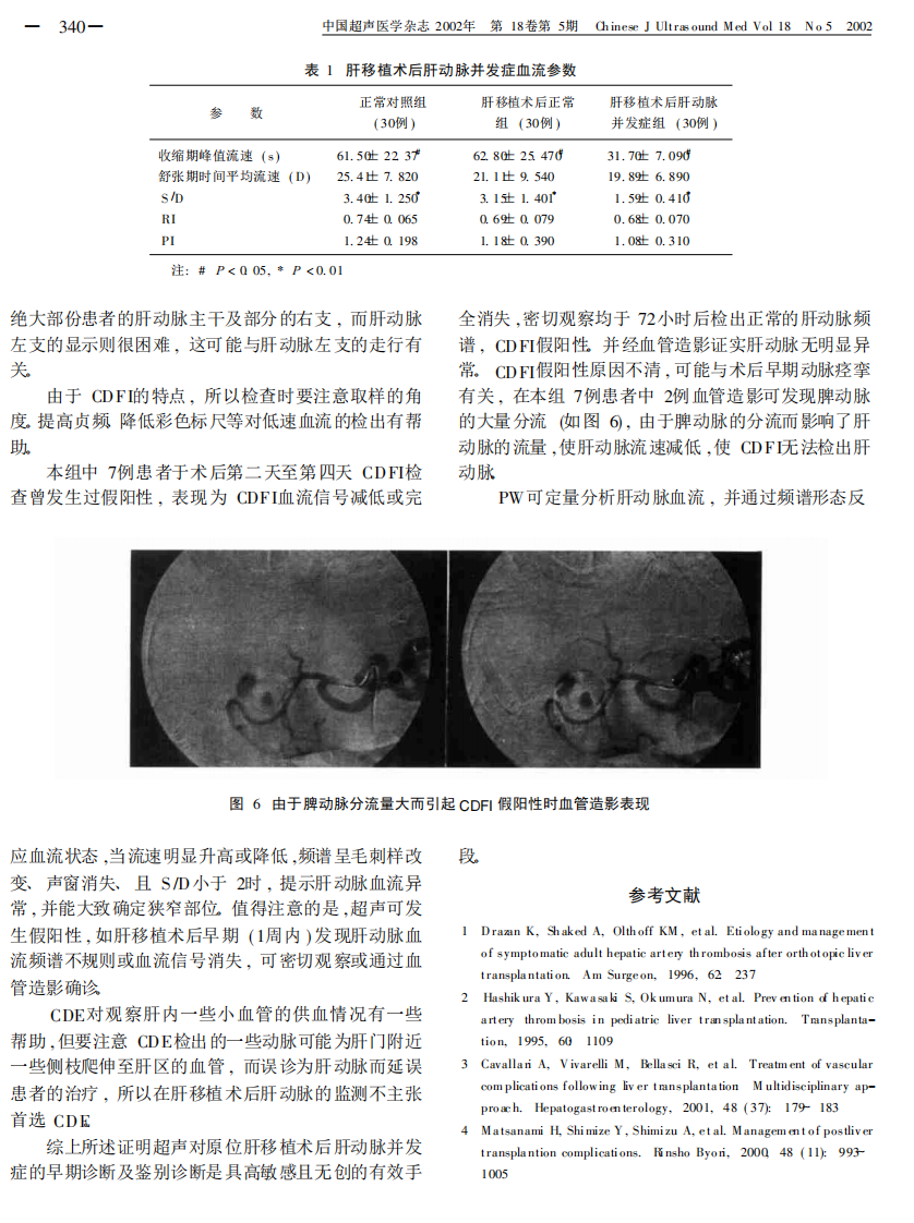 23超声对原位肝移植术后肝动脉并发症诊断新认识.pdf 第3页
