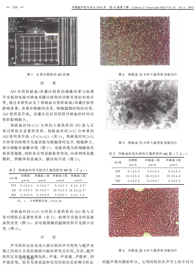 24）利用声学密度定量技术快速评价大鼠供肝质量的实验研究.pdf 第2页