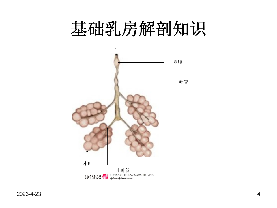 对乳腺增生的认识.ppt 第4页