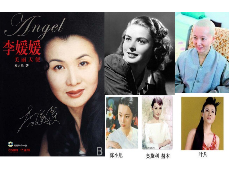 乳腺癌筛查与BI-RADS分类报告的解读.ppt 第3页