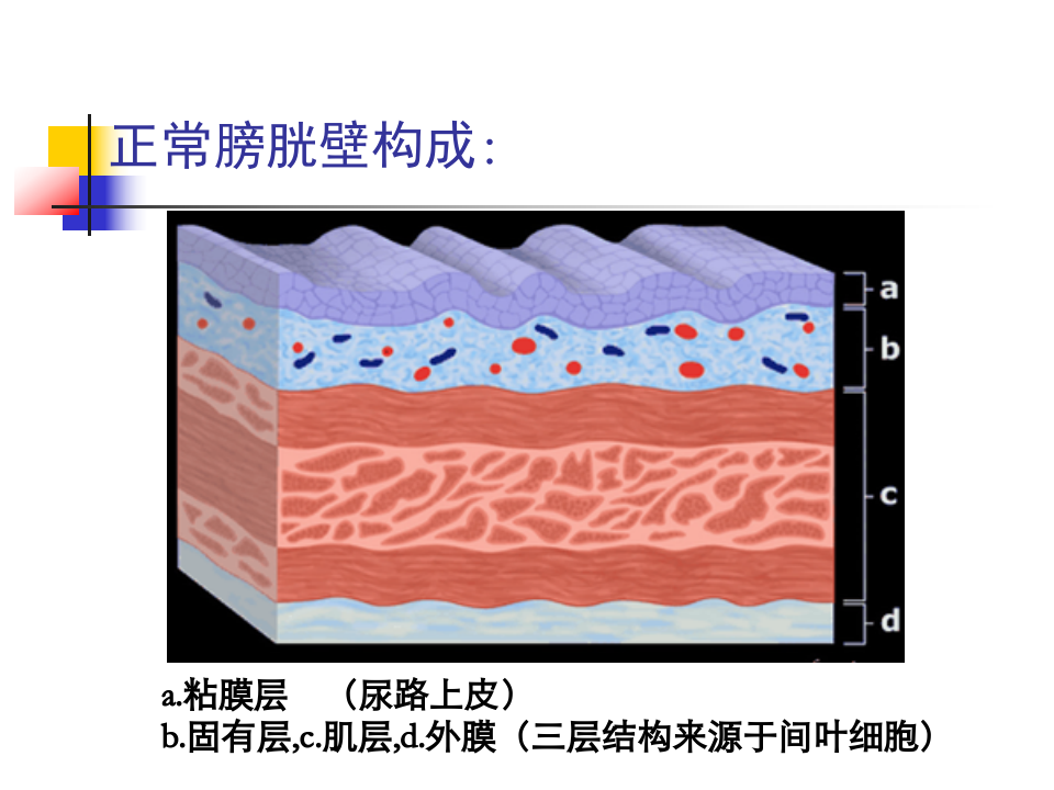 膀胱肿瘤（非移行上皮） 影像表现及病理—田为中主任.ppt 第2页
