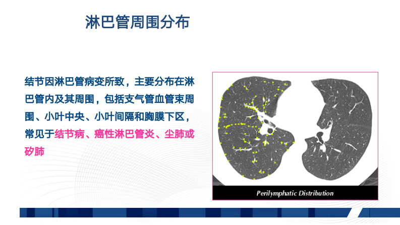 肺部弥漫性病变的HRCT诊断（张同）.pdf 第5页