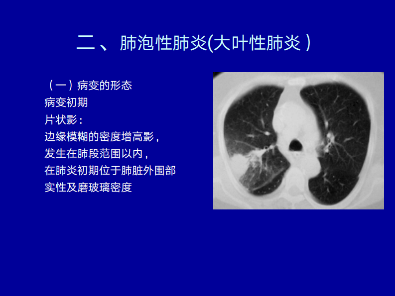 细菌性肺炎的影像诊断2019.pdf 第4页