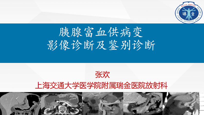 胰腺富血供占位诊断及鉴别诊断--张欢.pdf 第1页