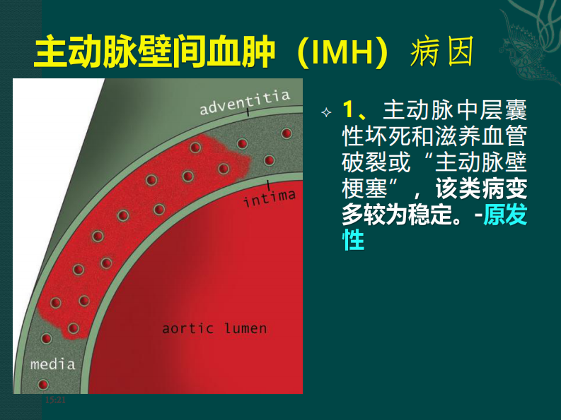 主动脉壁间血肿（IMH）--黄伟.pdf 第5页
