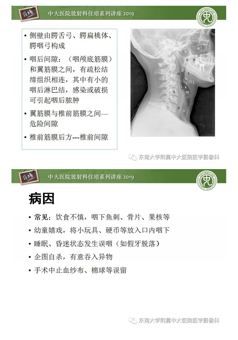 20190316_1【中大放射住培系列讲座第53期】口咽部异物及感染性病变的影像诊断.pdf 第3页