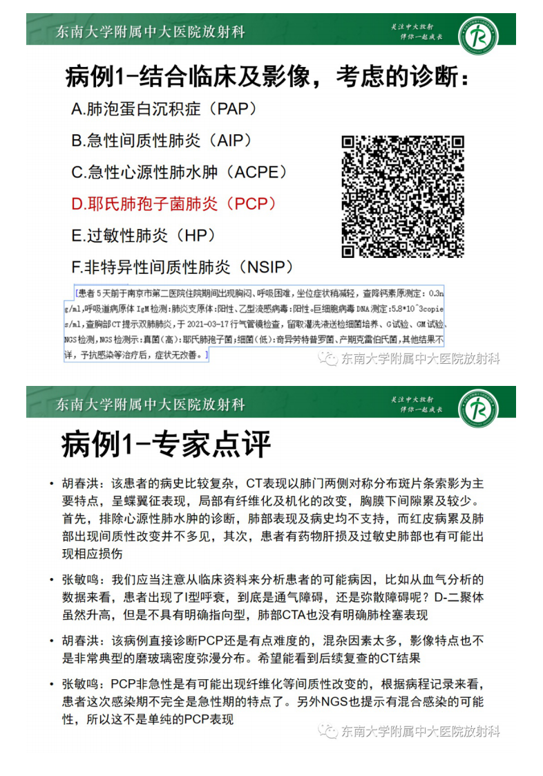 20210412_3【晨读结果公布】2021.04.12呼吸系统疾病——病例1：耶氏肺孢子菌肺炎（PCP）；病例2：急性心源性肺水肿（ACPE）.pdf 第5页