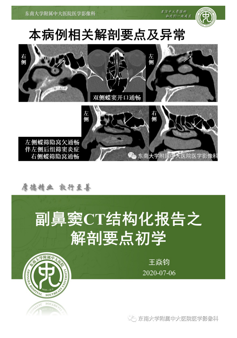 20200707_2【晨读结果公布】2020.07.06头颈部疾病——副鼻窦解剖变异.pdf 第5页
