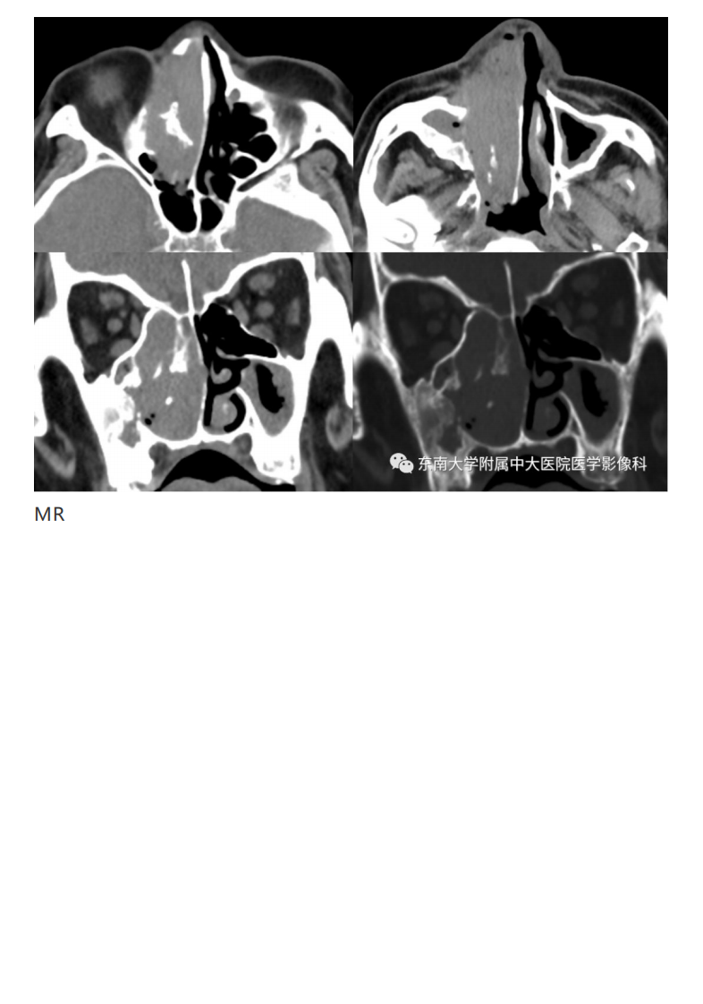 20190325_2【晨读结果公布】2019.03.25头颈部系统疾病.pdf 第5页