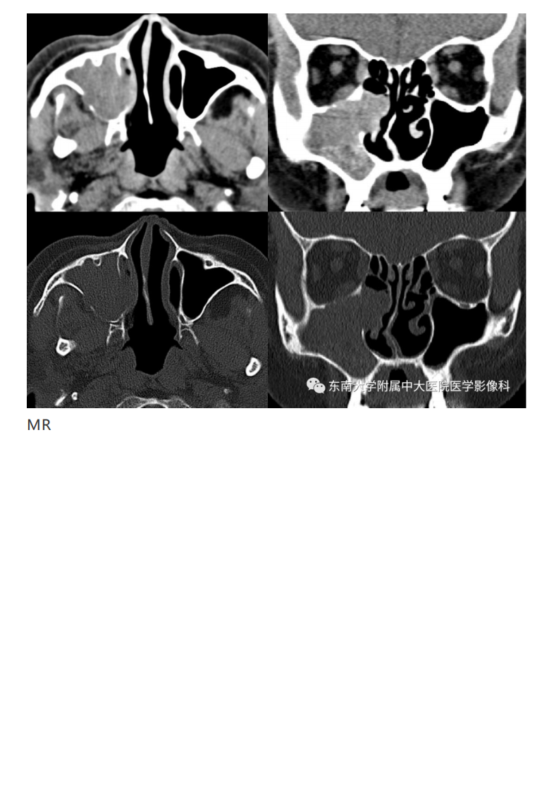 20190325_2【晨读结果公布】2019.03.25头颈部系统疾病.pdf 第3页