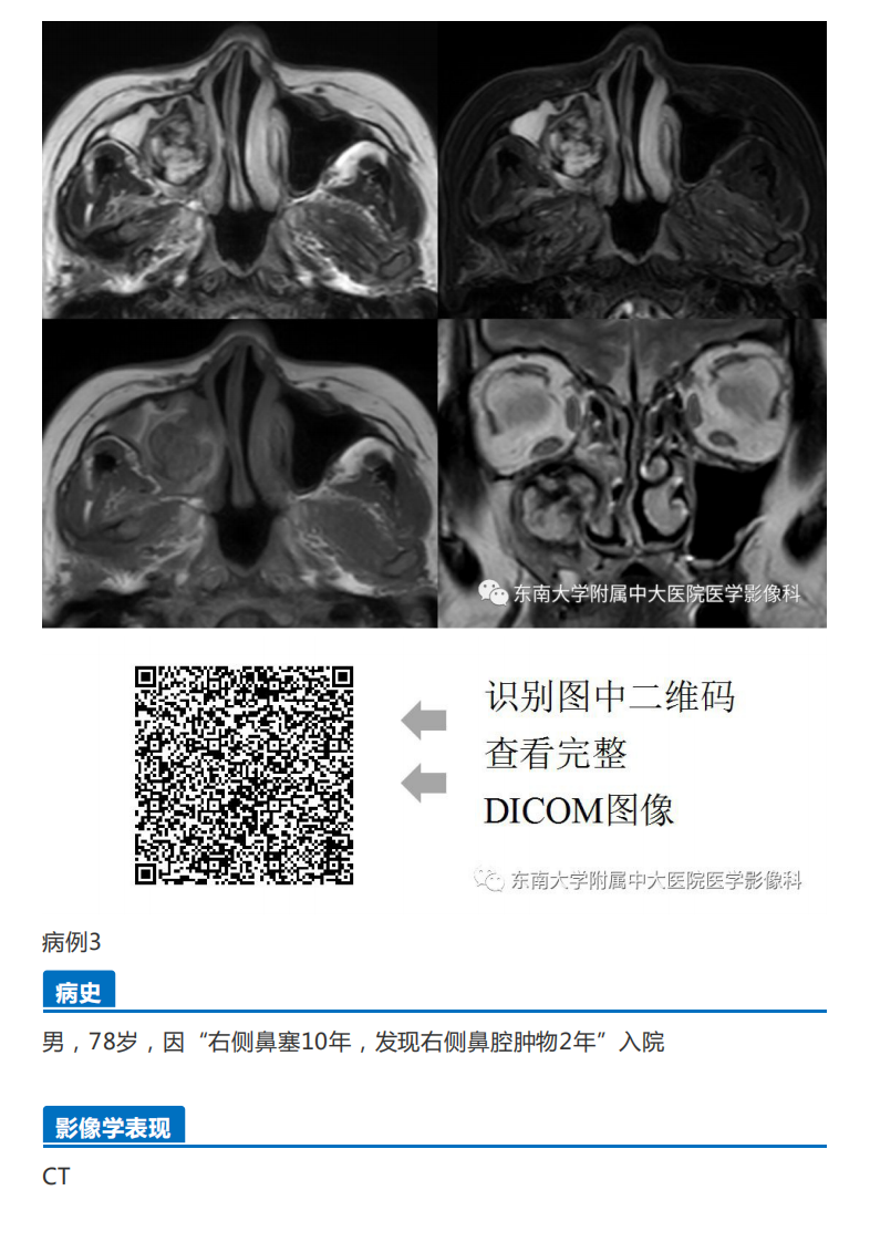 20190325_2【晨读结果公布】2019.03.25头颈部系统疾病.pdf 第4页