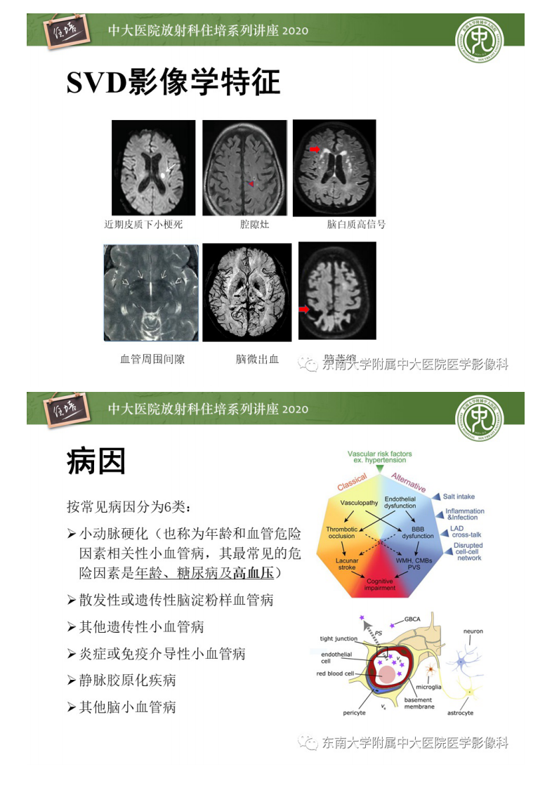 20201108_1【中大放射住培系列讲座】脑小血管病影像解读.pdf 第4页