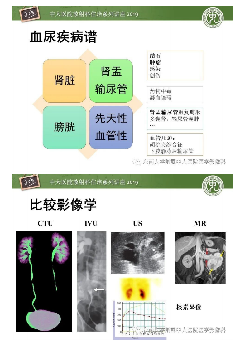 20200319_2【中大放射住培系列讲座】血尿的影像分析思路.pdf 第4页