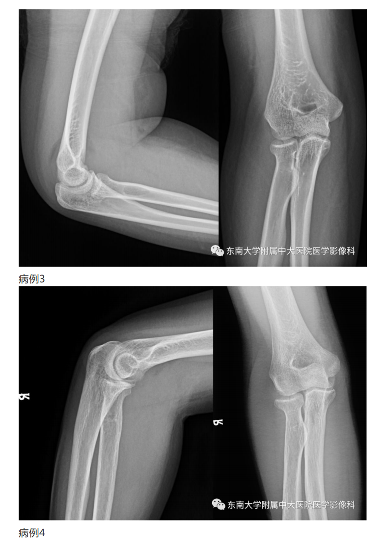 20190409_2【晨读结果公布】2019.04.08肌骨系统疾病.pdf 第2页