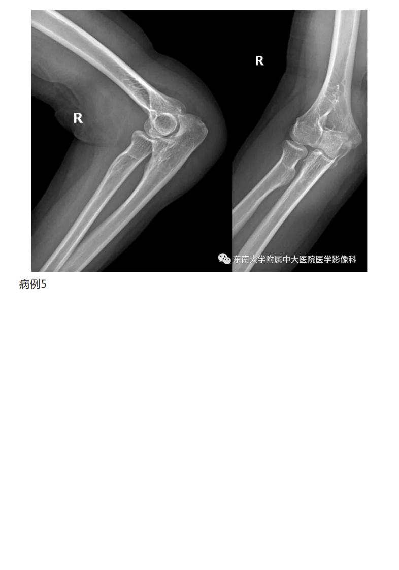 20190409_2【晨读结果公布】2019.04.08肌骨系统疾病.pdf 第3页
