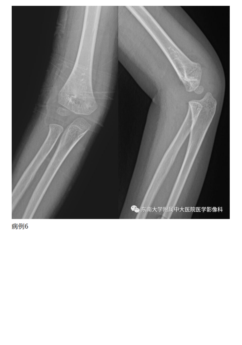 20190409_2【晨读结果公布】2019.04.08肌骨系统疾病.pdf 第4页