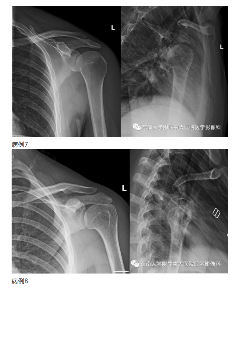 20190409_2【晨读结果公布】2019.04.08肌骨系统疾病.pdf 第5页