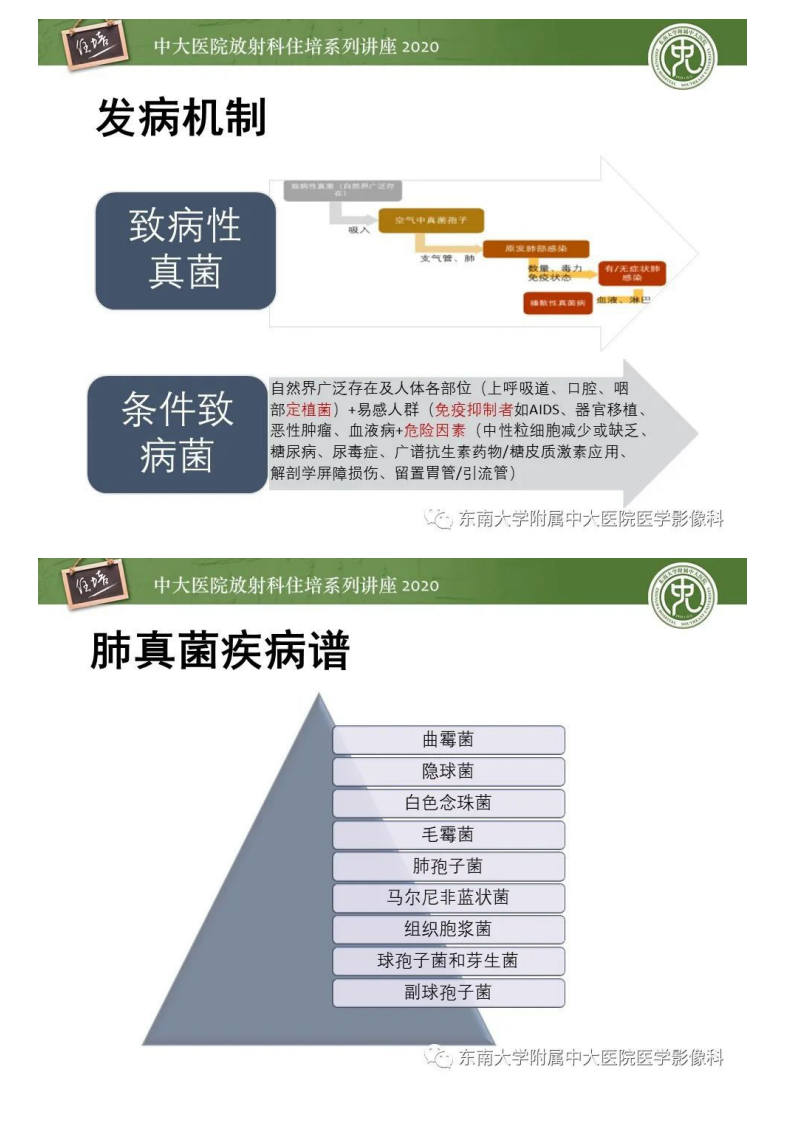 20200927_1【中大放射住培系列讲座】肺真菌病的影像诊断.pdf 第5页