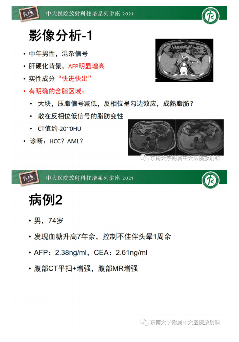 20210418_2【中大放射住培系列讲座】肝脏常见含脂病变.pdf 第3页