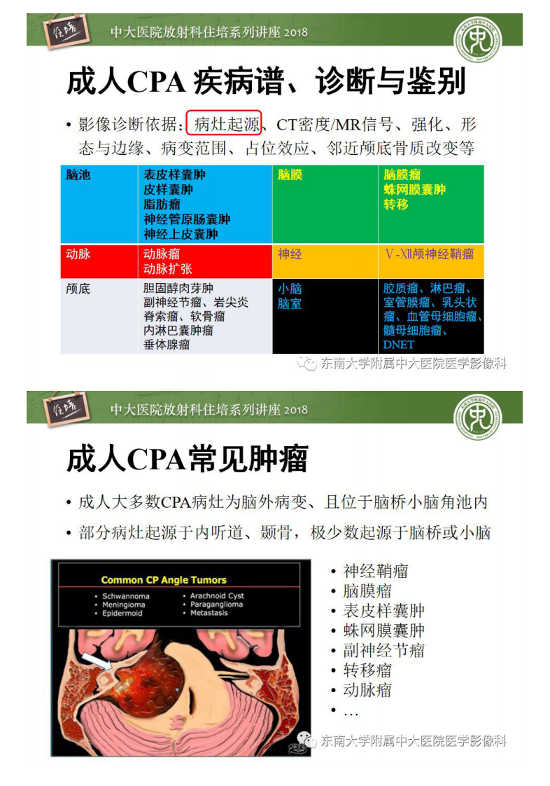 20190609_1【中大放射住培系列讲座第64期】成人桥小脑角区占位性病变影像诊断思路.pdf 第4页
