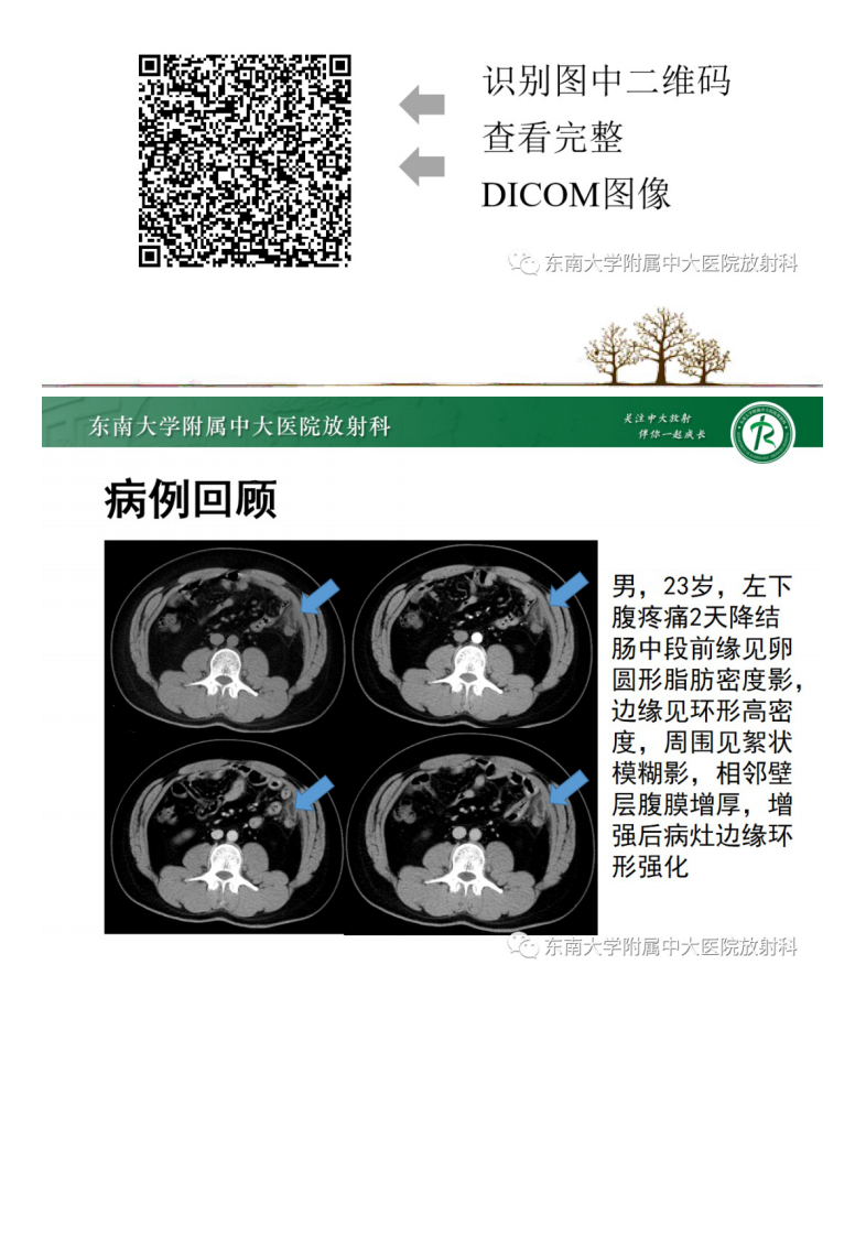 20210528_2【晨读结果公布】2021.05.27消化系统疾病——原发性肠脂垂炎.pdf 第2页