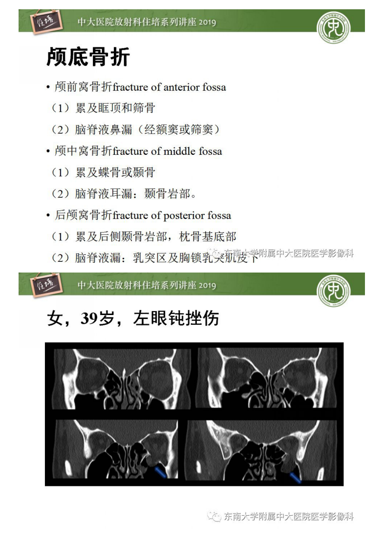 20190224_1【中大放射住培系列讲座第50期】成人颅脑损伤影像评估基本原则.pdf 第3页