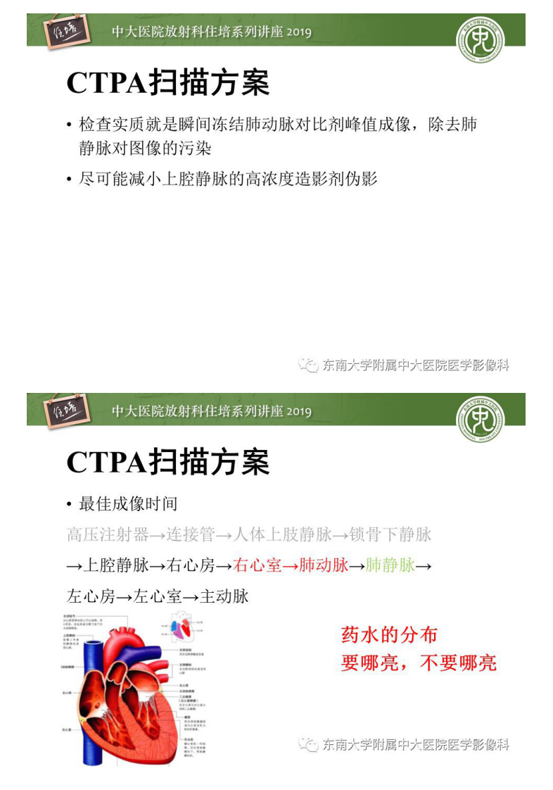 20200210_1【中大放射住培系列讲座】肺动脉栓塞扫描流程、三维重建及影像评估.pdf 第5页