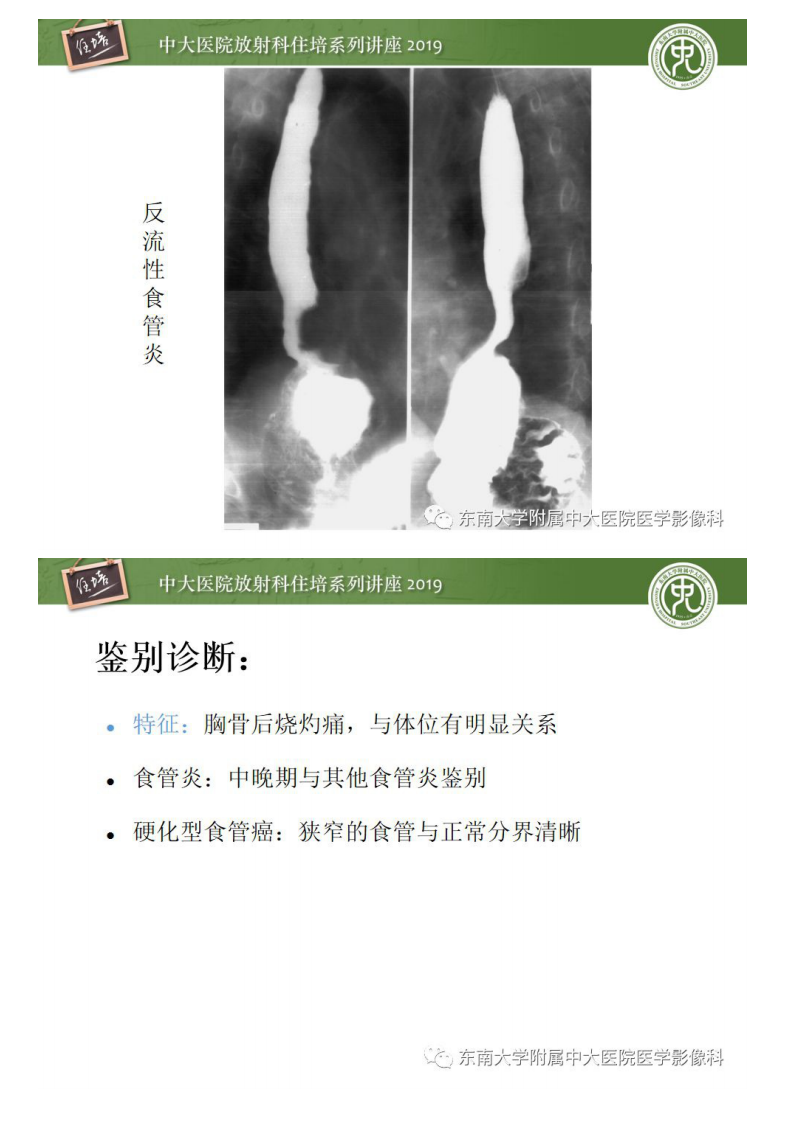 20190616_1【中大放射住培系列讲座第65期】食管常见疾病的诊断和鉴别诊断.pdf 第5页