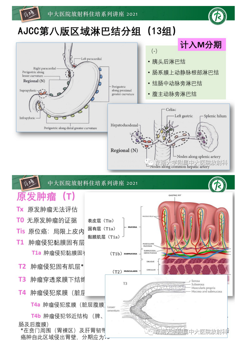 20210614_1【中大放射住培系列讲座】AJCC第8版胃癌TNM分期解读及影像学评估.pdf 第4页