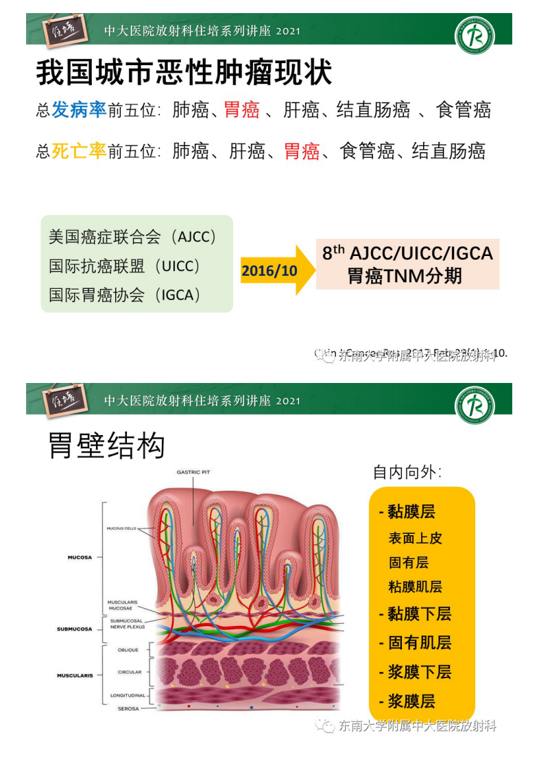 20210614_1【中大放射住培系列讲座】AJCC第8版胃癌TNM分期解读及影像学评估.pdf 第2页