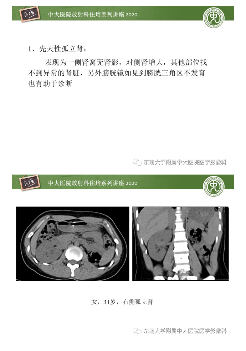 20201116_1【中大放射住培系列讲座】泌尿系统先天发育异常的影像表现.pdf 第3页