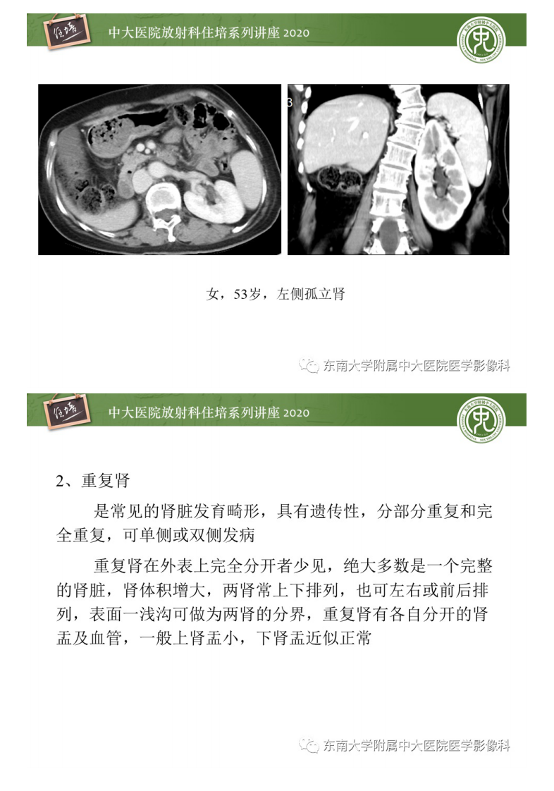 20201116_1【中大放射住培系列讲座】泌尿系统先天发育异常的影像表现.pdf 第4页