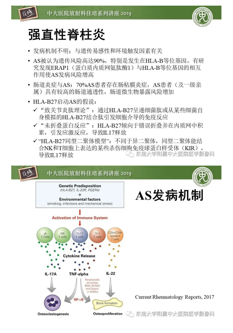 20200301_1【中大放射住培系列讲座】强直性脊柱炎影像学评估.pdf 第5页