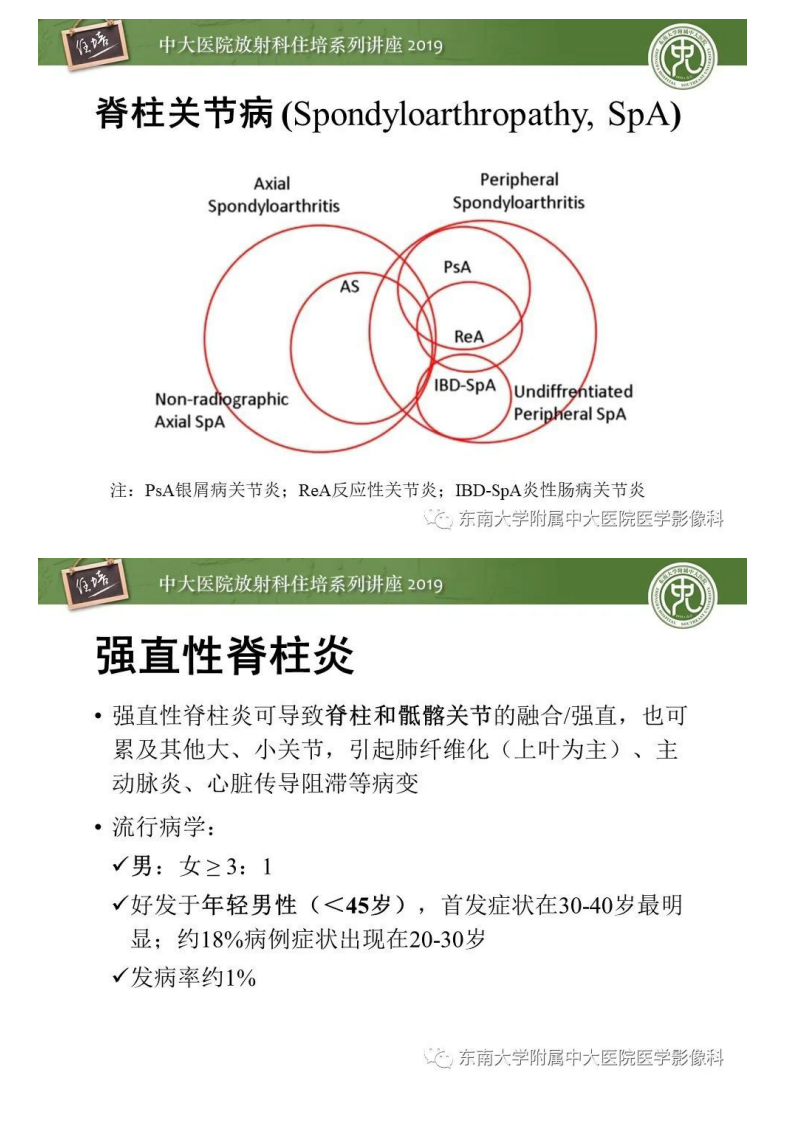 20200301_1【中大放射住培系列讲座】强直性脊柱炎影像学评估.pdf 第4页