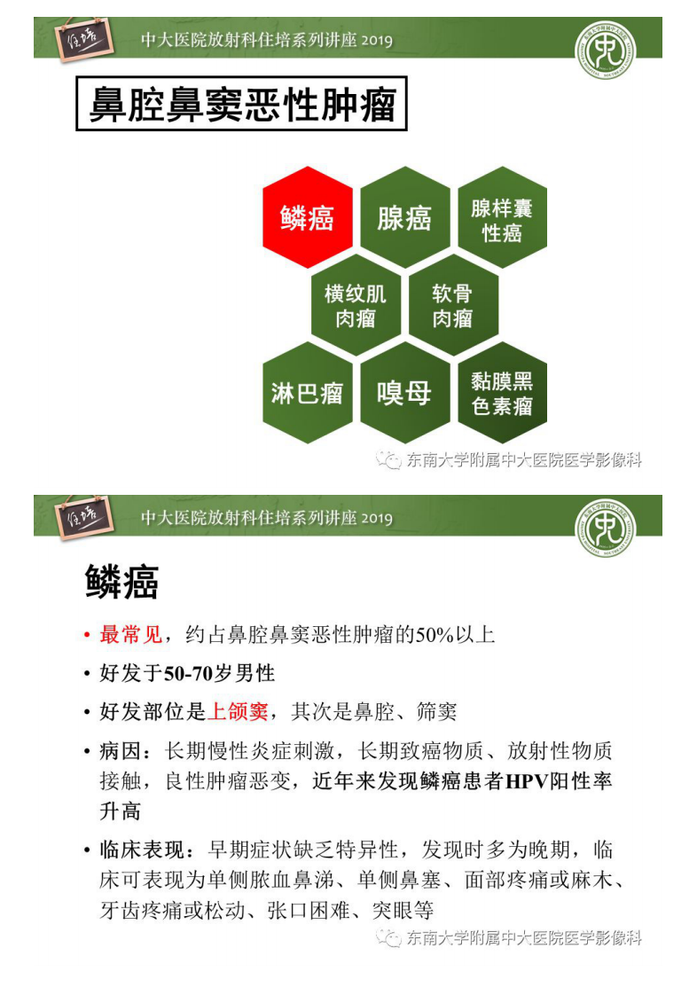 20200202_1【中大放射住培系列讲座】鼻腔鼻窦恶性肿瘤影像诊断.pdf 第5页