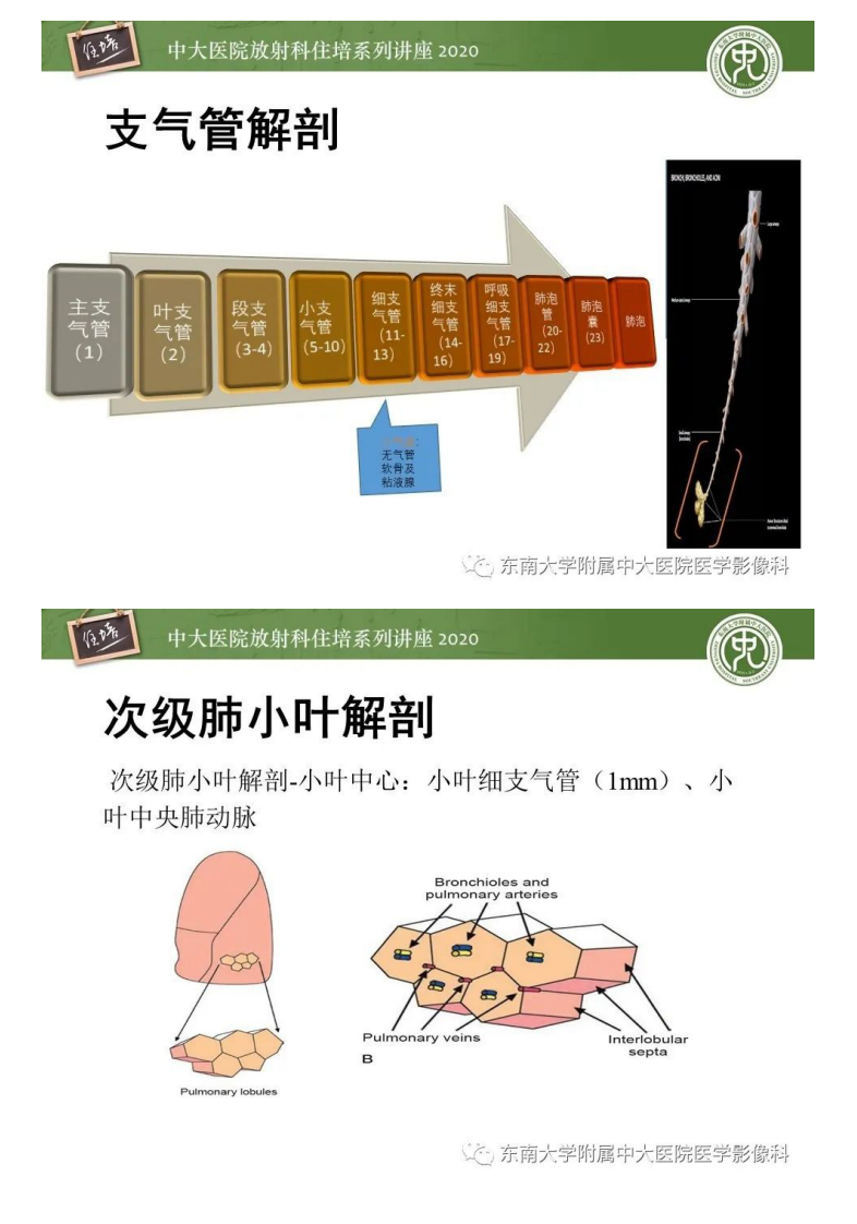 20200520_1【中大放射住培系列讲座】肺内常见影像征象解读（树芽征、指套征）.pdf 第3页