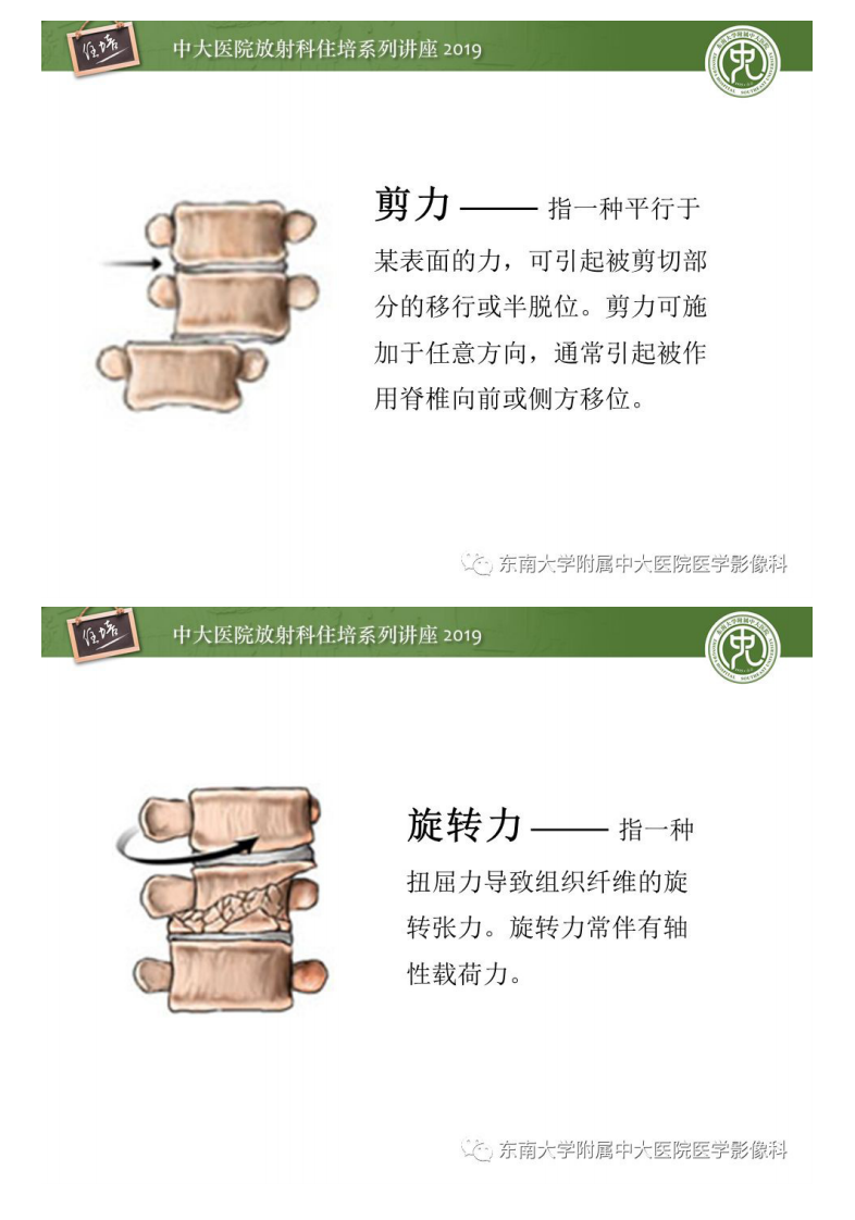 20190915_1【2019住培系列讲座第77期】脊柱创伤.pdf 第5页