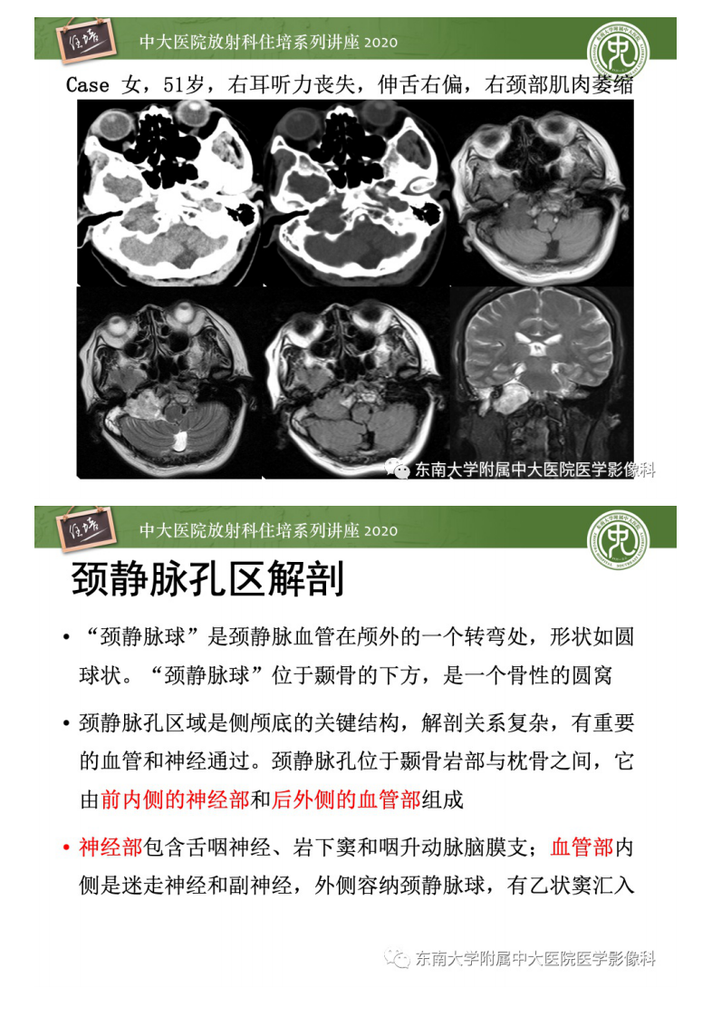 20201228_1【中大放射住培系列讲座】头颈部神经源性肿瘤的影像诊断.pdf 第4页