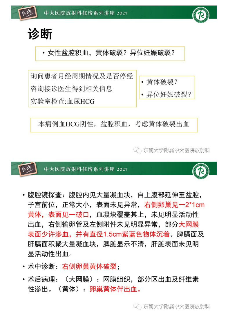 20210627_2【中大放射住培系列讲座】卵巢黄体及相关疾病诊断及鉴别.pdf 第3页
