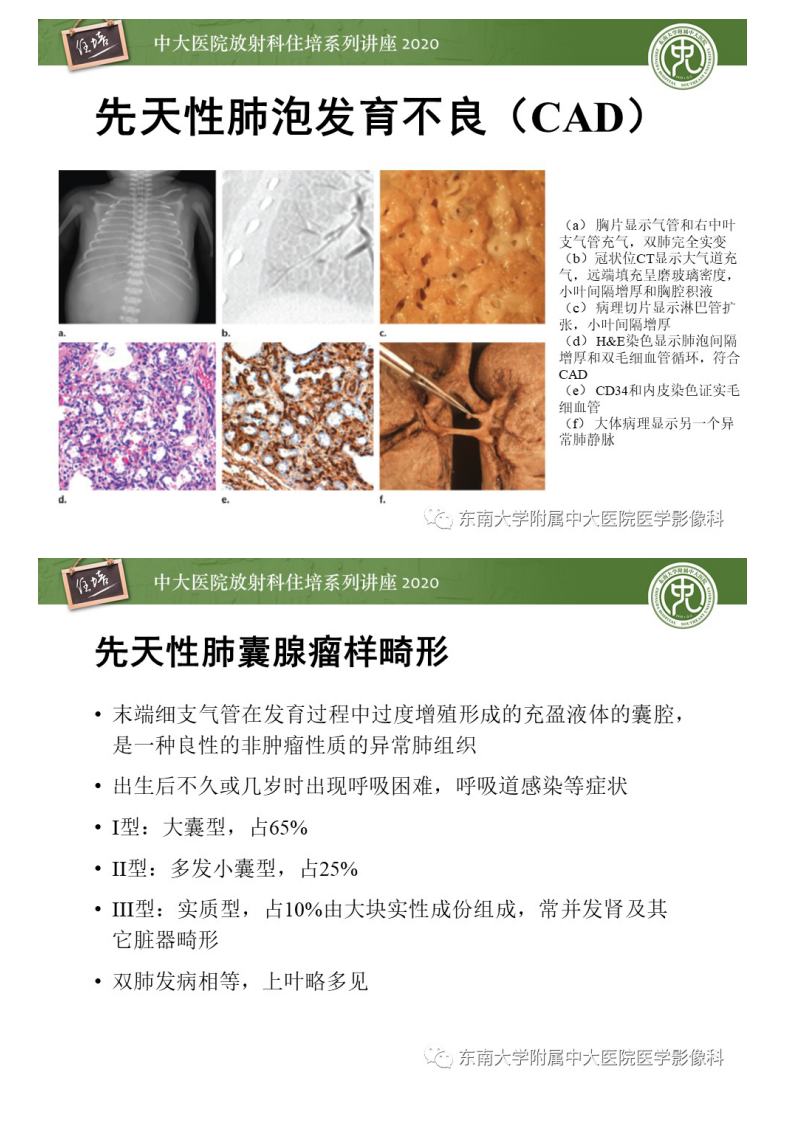 20200810_1【中大放射住培系列讲座】新生儿呼吸窘迫的影像诊断及分析.pdf 第5页