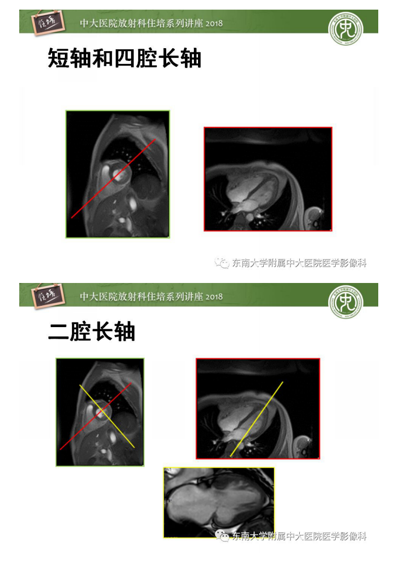 20190202_1【2018住培系列讲座第48期】心脏磁共振成像应用基础.pdf 第5页