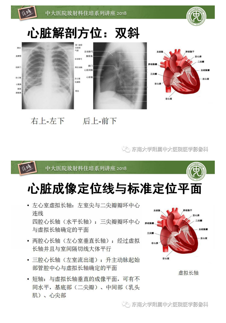 20190202_1【2018住培系列讲座第48期】心脏磁共振成像应用基础.pdf 第3页