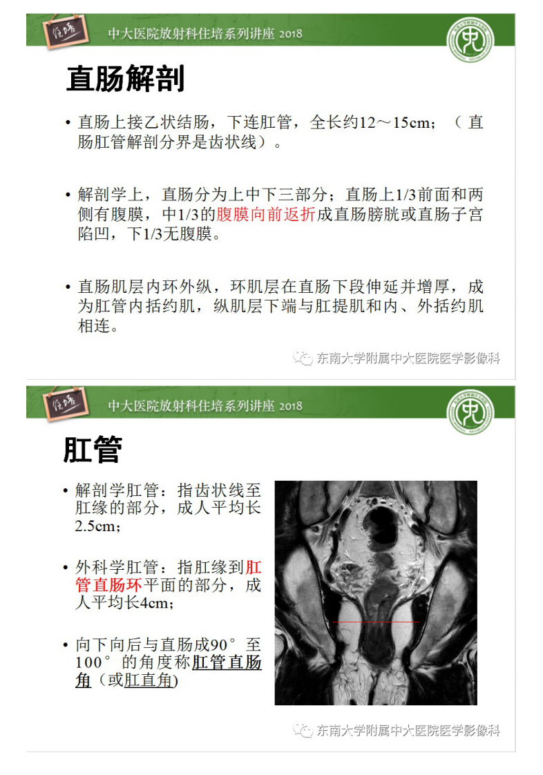 20200409_1【中大放射住培系列讲座】直肠癌MR分期及报告.pdf 第2页